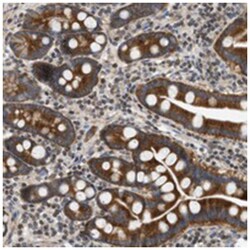 STRN Rabbit anti-Human, Mouse, Rat, Polyclonal Antibody, Abnova 100 &mu;L | Buy Online | Abnova Corporation | Fisher Scientific