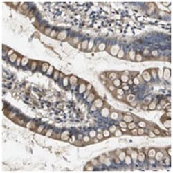 SCN4B, Rabbit, Polyclonal Antibody, Abnova 100&mu;L; Unlabeled:Antibodies,