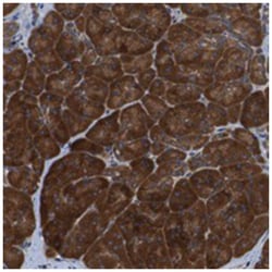 PTPRT, Rabbit, Polyclonal Antibody, Abnova 100 &mu;L | Buy Online | Abnova Corporation | Fisher Scientific