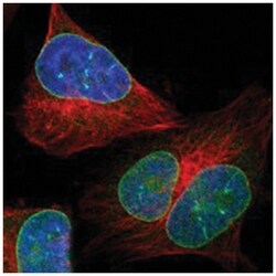 LEMD2 Rabbit anti-Human, Polyclonal Antibody, Abnova 100 &mu;L | Buy Online | Abnova | Fisher Scientific