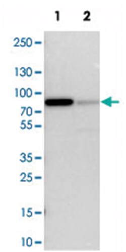 LPP Rabbit anti-Human, Mouse, Rat, Polyclonal Antibody, Abnova 100 &mu;L | Buy Online | Abnova Corporation | Fisher Scientific