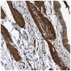 LPP Rabbit anti-Human, Mouse, Rat, Polyclonal Antibody, Abnova 100 &mu;L | Buy Online | Abnova Corporation | Fisher Scientific