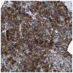 KCNJ5 Rabbit anti-Human, Polyclonal Antibody, Abnova 100&mu;L; Unlabeled:Antibodies,
