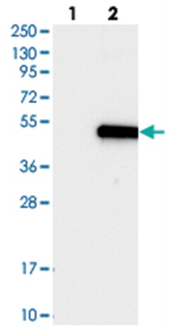KCNJ5 Rabbit anti-Human, Polyclonal Antibody, Abnova 100&mu;L; Unlabeled:Antibodies,