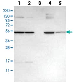 GALNAC4S-6ST, Rabbit, Polyclonal Antibody, Abnova 100 &mu;L | Buy Online | Abnova | Fisher Scientific