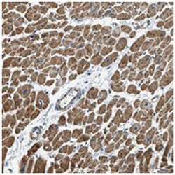 GALNAC4S-6ST, Rabbit, Polyclonal Antibody, Abnova 100 &mu;L | Buy Online | Abnova | Fisher Scientific