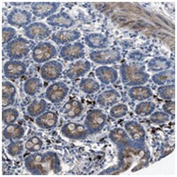 SGCZ, Rabbit, Polyclonal Antibody, Abnova 100&mu;L; Unlabeled:Antibodies,