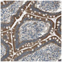 FAM73A, Rabbit, Polyclonal Antibody, Abnova 100&mu;L; Unlabeled:Antibodies,