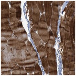 ABRA, Rabbit, Polyclonal Antibody, Abnova 100 &mu;L | Buy Online | Abnova Corporation | Fisher Scientific