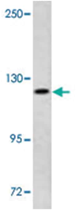 PUM1, Rabbit, Polyclonal Antibody, Abnova 400&mu;L; Unlabeled:Antibodies,
