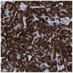 PRSS16, Rabbit, Polyclonal Antibody, Abnova 100 &mu;L | Buy Online | Abnova Corporation | Fisher Scientific