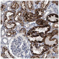 ADCY10 Rabbit anti-Human, Polyclonal Antibody, Abnova 100&mu;L; Unlabeled:Antibodies,