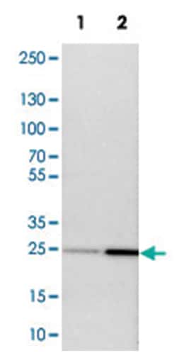 NDRG3 Rabbit anti-Human, Mouse, Rat, Polyclonal Antibody, Abnova 100&mu;L;