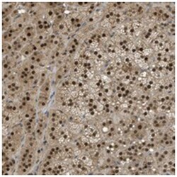 PSMC5 Rabbit anti-Human, Polyclonal Antibody, Abnova 100 &mu;L | Buy Online | Abnova Corporation | Fisher Scientific