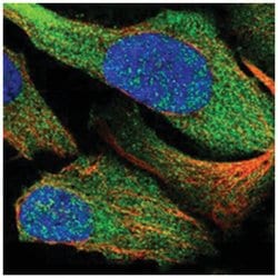 PSMC5 Rabbit anti-Human, Polyclonal Antibody, Abnova 100 &mu;L | Buy Online | Abnova Corporation | Fisher Scientific