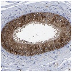 FRRS1, Rabbit, Polyclonal Antibody, Abnova 100&mu;L; Unlabeled:Antibodies,