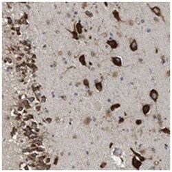 SLC36A4, Rabbit, Polyclonal Antibody, Abnova 100&mu;L; Unlabeled:Antibodies,