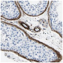 COL15A1 Rabbit anti-Human, Polyclonal Antibody, Abnova 100&mu;L; Unlabeled:Antibodies,