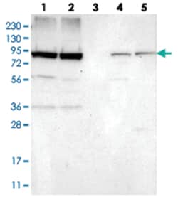 NUP93, Rabbit, Polyclonal Antibody, Abnova 100 &mu;L | Buy Online | Abnova Corporation | Fisher Scientific