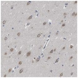 NUP93, Rabbit, Polyclonal Antibody, Abnova 100 &mu;L | Buy Online | Abnova Corporation | Fisher Scientific