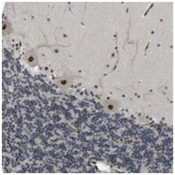 LRRC8B, Rabbit, Polyclonal Antibody, Abnova 100 &mu;L | Buy Online | Abnova Corporation | Fisher Scientific