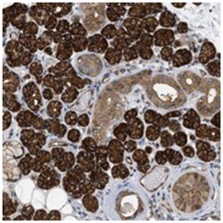 PALMD, Rabbit, Polyclonal Antibody, Abnova 100&mu;L; Unlabeled:Antibodies,