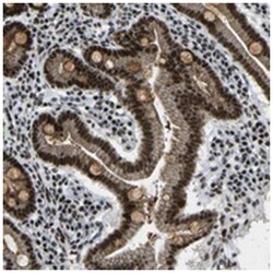 FOXK1 Rabbit anti-Human, Polyclonal Antibody, Abnova 100&mu;L; Unlabeled:Antibodies,