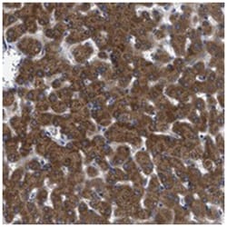 C22orf15 Rabbit anti-Human, Polyclonal Antibody, Abnova 100 &mu;L | Buy Online | Abnova Corporation | Fisher Scientific