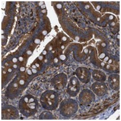 C10orf118 Rabbit anti-Human, Polyclonal Antibody, Abnova 100 &mu;L | Buy Online | Abnova Corporation | Fisher Scientific