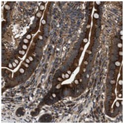 LYSMD3, Rabbit, Polyclonal Antibody, Abnova 100 &mu;L | Buy Online | Abnova Corporation | Fisher Scientific