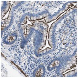 TMEM180, Rabbit, Polyclonal Antibody, Abnova 100 &mu;L | Buy Online | Abnova Corporation | Fisher Scientific