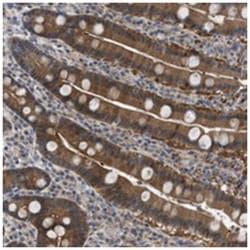 TMEM159, Rabbit, Polyclonal Antibody, Abnova 100 &mu;L | Buy Online | Abnova Corporation | Fisher Scientific