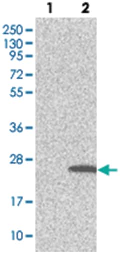 TMEM159, Rabbit, Polyclonal Antibody, Abnova 100 &mu;L | Buy Online | Abnova Corporation | Fisher Scientific