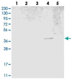 SVOPL, Rabbit, Polyclonal Antibody, Abnova 100&mu;L; Unlabeled:Antibodies,