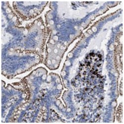 TMEM77, Rabbit, Polyclonal Antibody, Abnova 100&mu;L; Unlabeled:Antibodies,