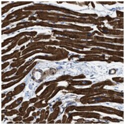 KCNH7, Rabbit, Polyclonal Antibody, Abnova 100&mu;L; Unlabeled:Antibodies,