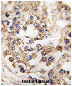 PDX1 Rabbit anti-Human, Polyclonal Antibody, Abnova 400&mu;L; Unlabeled:Antibodies,
