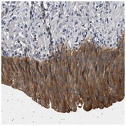 PPAPDC2 Rabbit anti-Human, Polyclonal Antibody, Abnova 100 &mu;L | Buy Online | Abnova Corporation | Fisher Scientific
