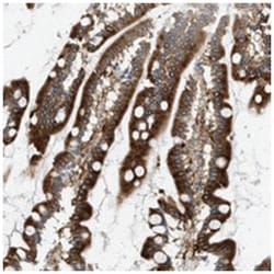 MCOLN3, Rabbit, Polyclonal Antibody, Abnova 100 &mu;L | Buy Online | Abnova Corporation | Fisher Scientific