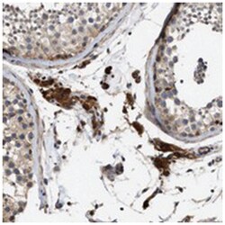 SLC4A11 Rabbit anti-Human, Polyclonal Antibody, Abnova 100 &mu;L | Buy Online | Abnova Corporation | Fisher Scientific