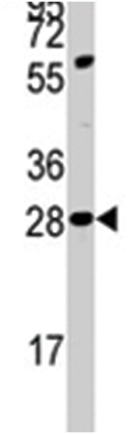 PDX1 Rabbit anti-Human, Polyclonal Antibody, Abnova 400 &mu;L | Buy Online | Abnova Corporation | Fisher Scientific