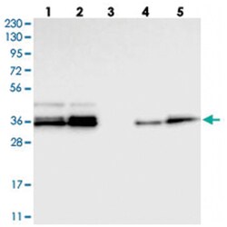 CALHM3, Rabbit, Polyclonal Antibody, Abnova 100 &mu;L | Buy Online | Abnova Corporation | Fisher Scientific