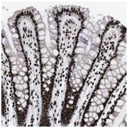 CALHM3, Rabbit, Polyclonal Antibody, Abnova 100 &mu;L | Buy Online | Abnova Corporation | Fisher Scientific