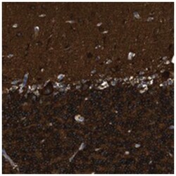 ZSWIM5, Rabbit, Polyclonal Antibody, Abnova 100 &mu;L | Buy Online | Abnova Corporation | Fisher Scientific