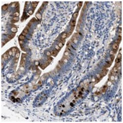 GUCA2A Rabbit anti-Human, Polyclonal Antibody, Abnova 100&mu;L; Unlabeled:Antibodies,