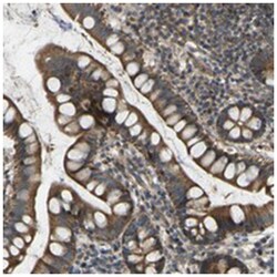 C21orf91, Rabbit, Polyclonal Antibody, Abnova 100 &mu;L | Buy Online | Abnova Corporation | Fisher Scientific