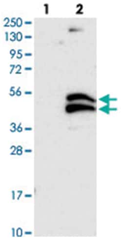 C21orf91, Rabbit, Polyclonal Antibody, Abnova 100 &mu;L | Buy Online | Abnova Corporation | Fisher Scientific