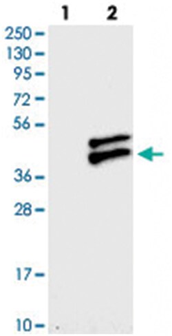 RWDD2B, Rabbit, Polyclonal Antibody, Abnova 100 &mu;L | Buy Online | Abnova Corporation | Fisher Scientific