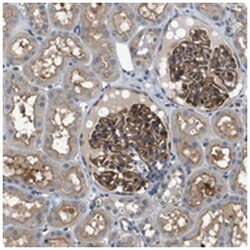 CBLB Rabbit anti-Human, Polyclonal Antibody, Abnova 100 &mu;L | Buy Online | Abnova Corporation | Fisher Scientific