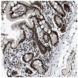 URB1, Rabbit, Polyclonal Antibody, Abnova 100 &mu;L | Buy Online | Abnova Corporation | Fisher Scientific